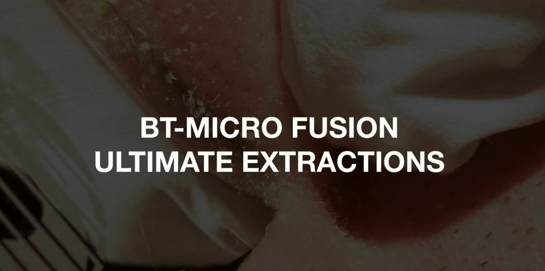 Extractions with the bt-micro fusion